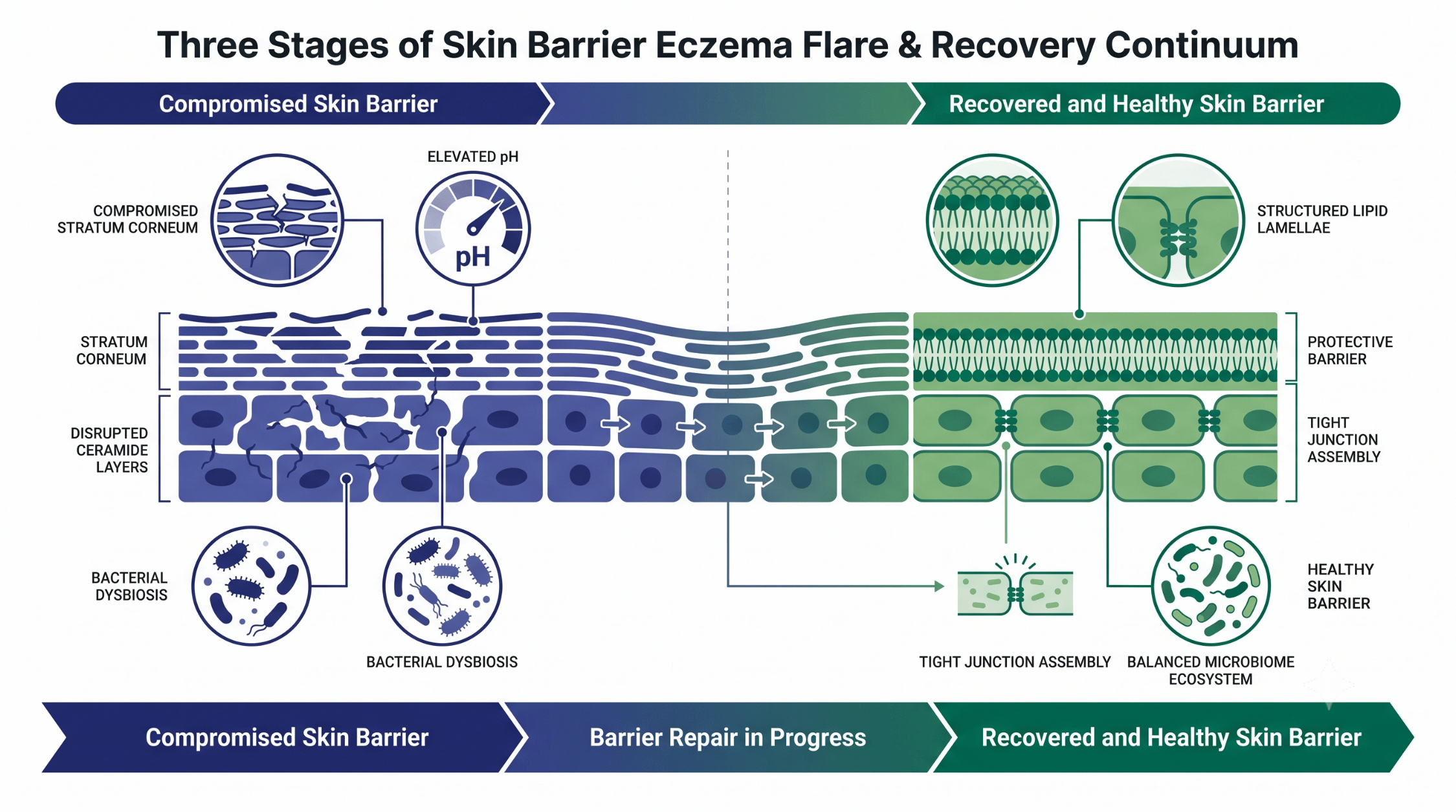Detailed infographic of the skin barrier eczema flare and recovery process, comparing a compromised skin barrier with elevated pH and disrupted lipids on the left, to a healthy, recovered barrier on the right with optimal lipid lamellae, tight junctions, 