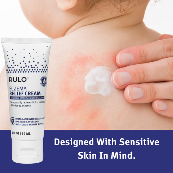 RULO Eczema Relief Cream applied to red, irritated skin – designed for sensitive and eczema-prone skin relief